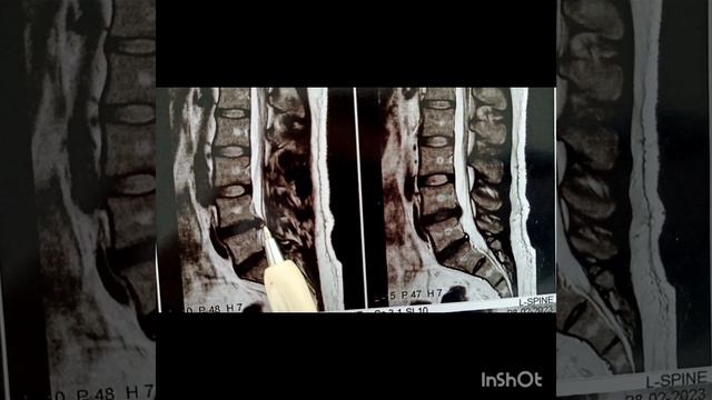 МРТ для начинающих реабилитологов и физических терапевтов смотреть онлайн