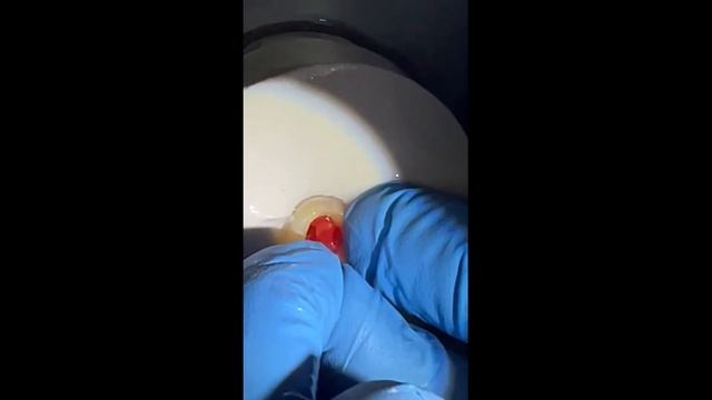 Моделирование штифтово-культевой вкладки прямым способом смотреть онлайн