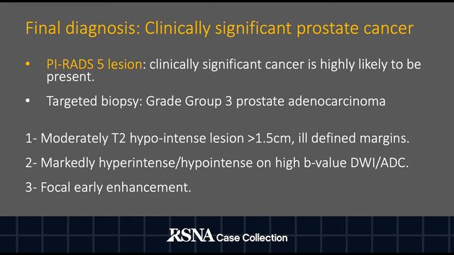 Case of the Week: Anterior Transition Zone Prostate Adenocarcinoma смотреть онлайн