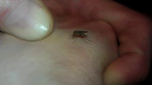 Укус комара. Комар пьет и сосет кровь. Как убить комара?