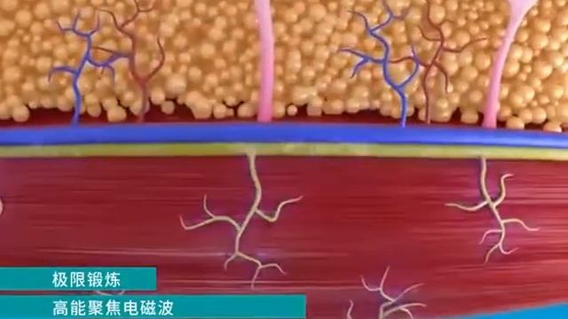 Аппарат EMS микротоки