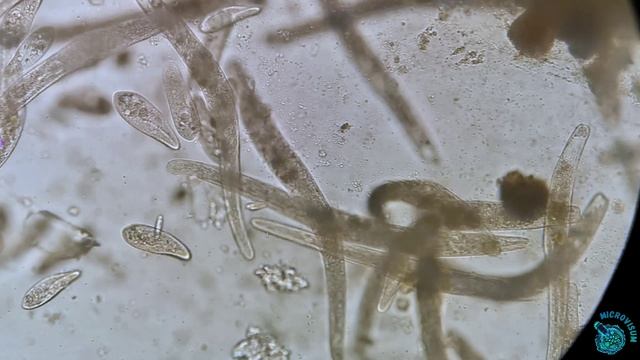 Насыщенная жизнь в капле воды смотреть онлайн