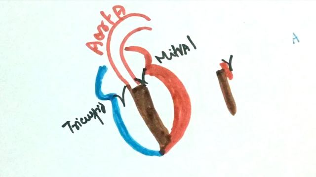 Cardiac Murmurs and Maneuvers: Valsalva, Handgrip, Squatting, Inspiration + Quiz смотреть онлайн