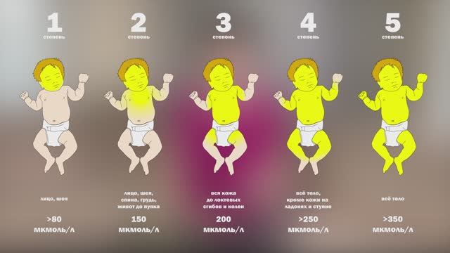 Желтуха новорожденных смотреть онлайн