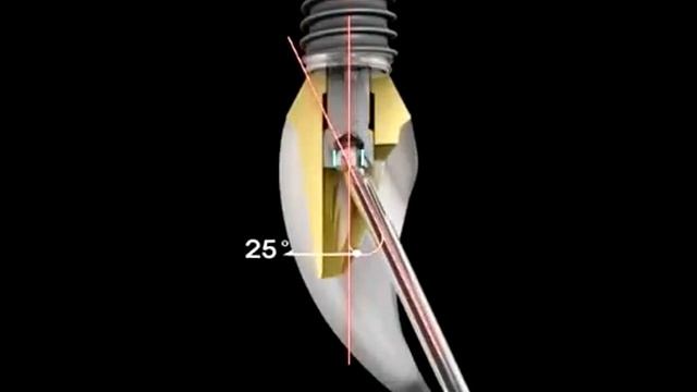 Neo Angle Driver смотреть онлайн