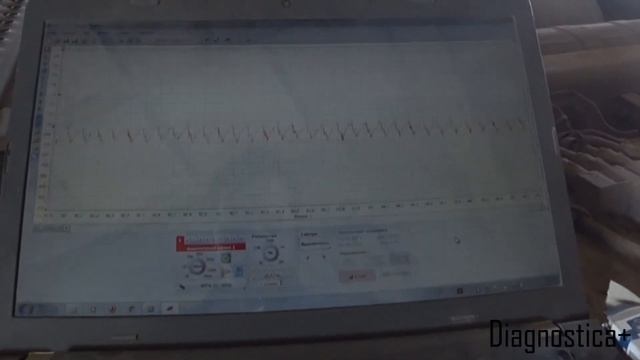 Диагностика скания