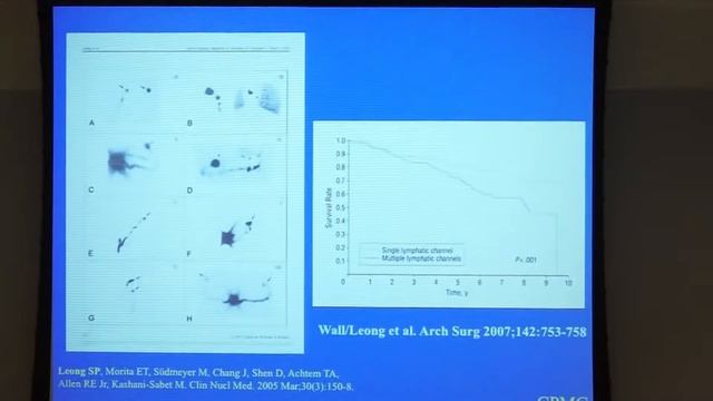Sentinel Lymph Node Biopsy in the Surgical Management of Melanoma смотреть онлайн