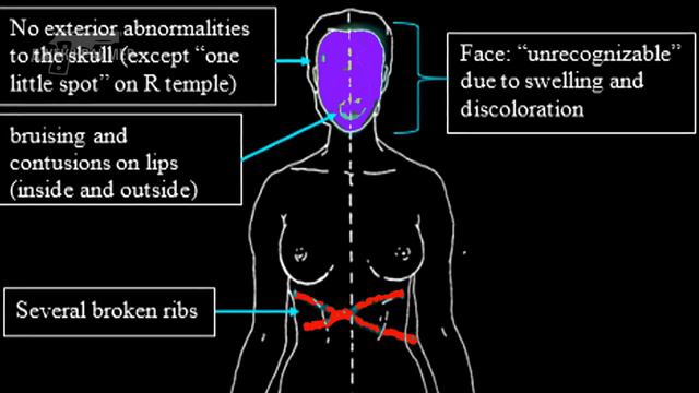 Переломы и синяки смерть слепой девушки до сих пор вызывает много вопросов. Holly Bartlett смотреть онлайн