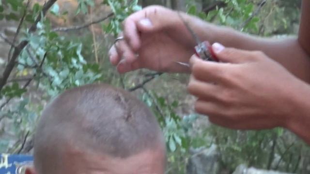 Снятие швов в антисанитарных условиях смотреть онлайн