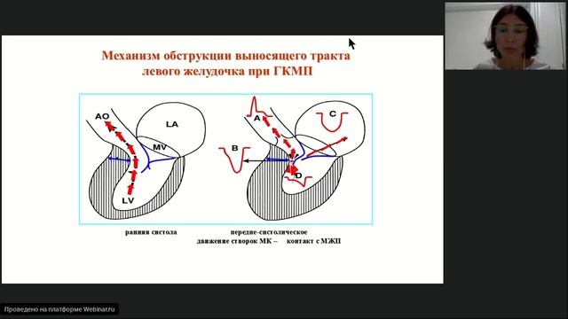 Вебинар2 по кардиологии. Федоришина О.В..mp4