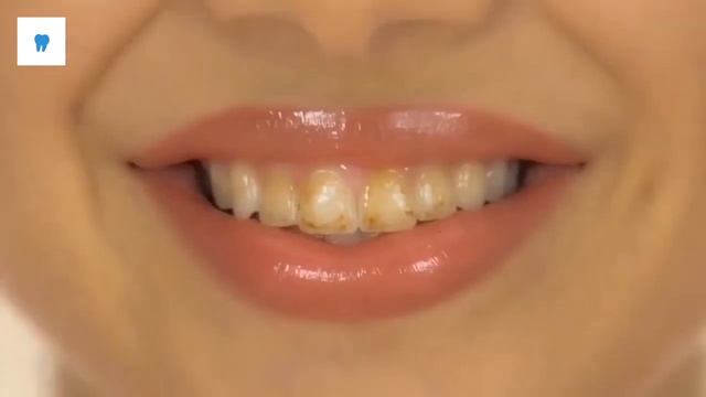 Ирригатор Улыбка смотреть онлайн