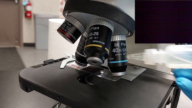 How to Find a Red Blood Cell with Oil Immersion смотреть онлайн