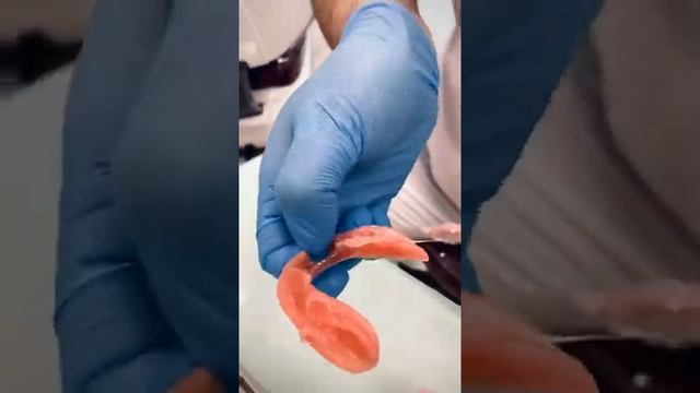 Подписывайтесь!Перебазировка съёмного протеза в стоматологии R.A.Dent! смотреть онлайн