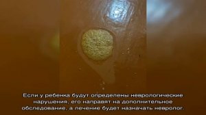 Рвота со слизью у ребенка