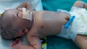 Перинатальный асфиксия