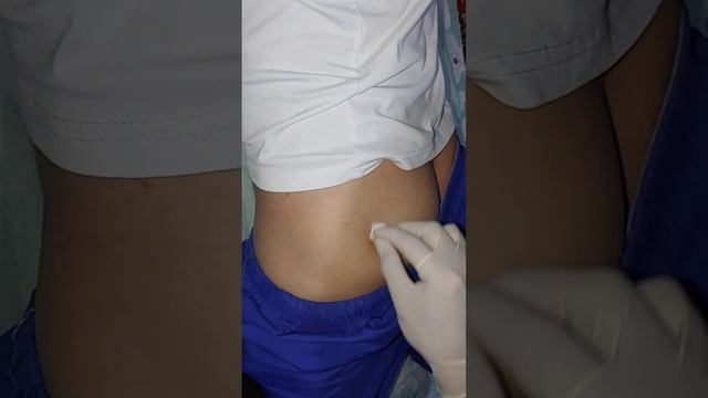 укол в ягодицу видео. Внутримышечная инъекция в ягодичную мышцу смотреть онлайн
