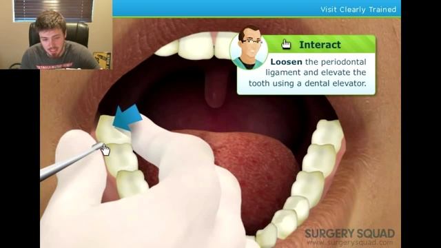 SURGERY SIMULATOR - WISDOM TOOTH (GAGGING) смотреть онлайн