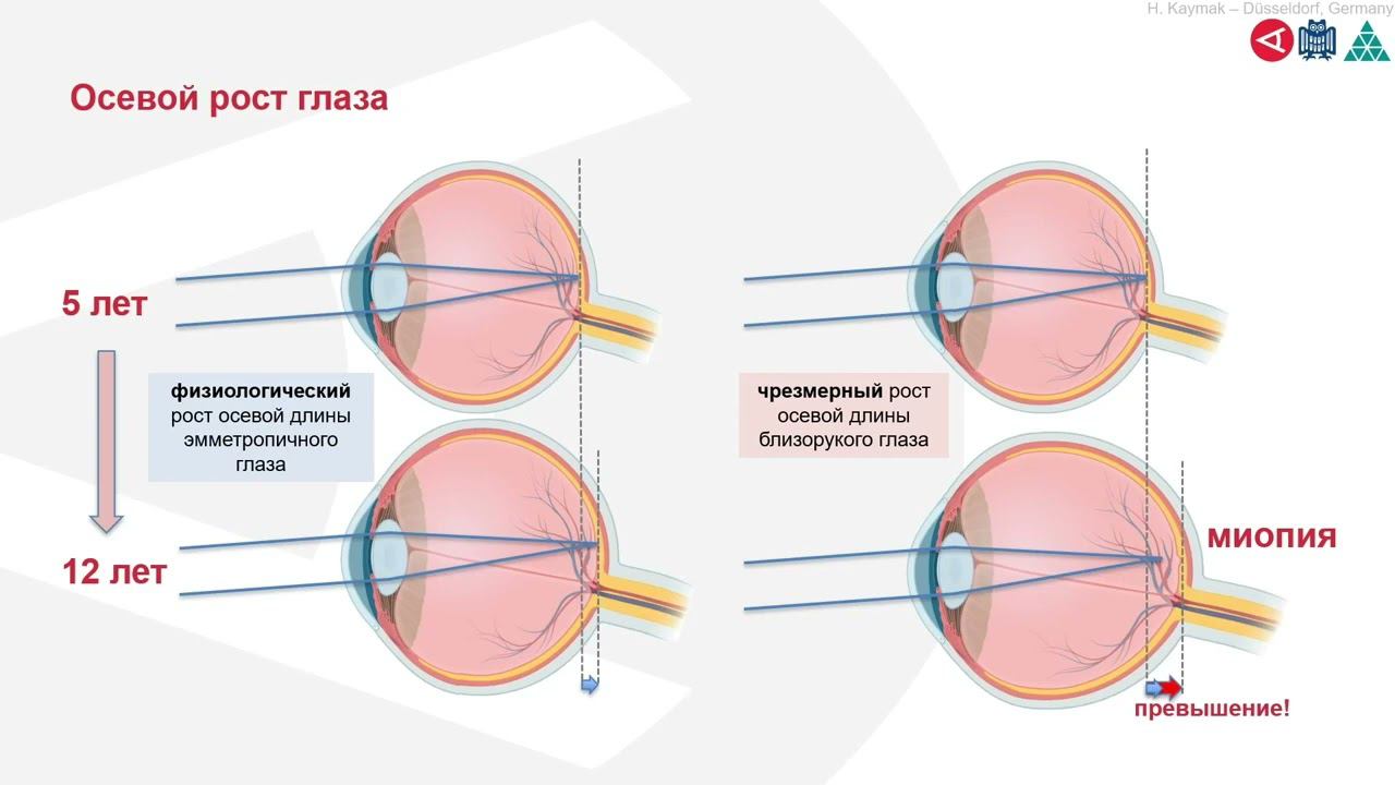 Линзы Хойя Рус