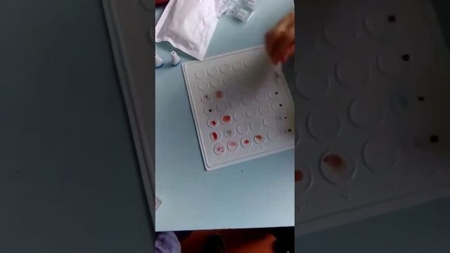 Определение группы крови и резус фактора с использованием цоликлонов смотреть онлайн