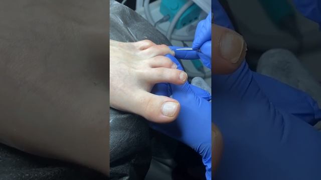 frozen nail Классическая обработка кутикулы в педикюре смотреть онлайн