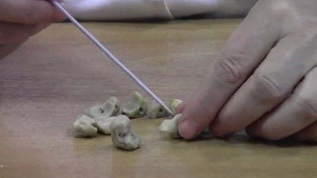 Кости кисти смотреть онлайн