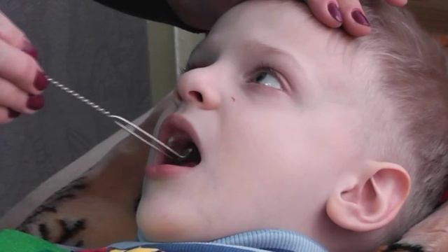 Логопедия. Мастер-класс по зондовому массажу для детей с недоразвитием речи смотреть онлайн