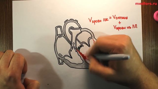 Аортальный стеноз - "Просто о сложном" смотреть онлайн