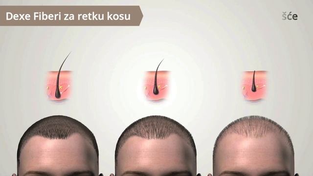 Dexe Fiberi za retku kosu смотреть онлайн