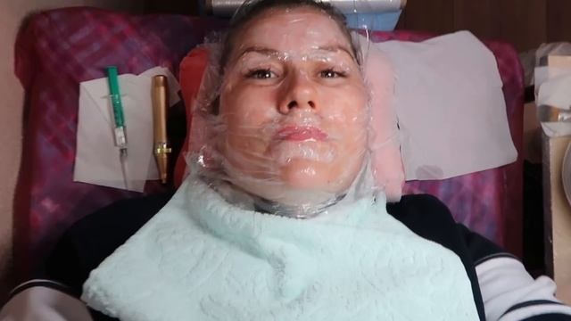 VLOG Убираю морщины. Процедура омоложения. смотреть онлайн