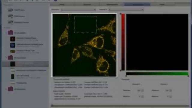 Performing a Colocalization Analysis in Volocity 3D Image Analysis Software смотреть онлайн