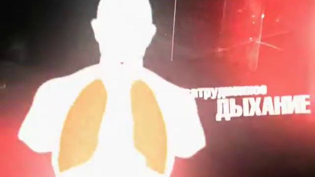 Птичий Грипп смотреть онлайн