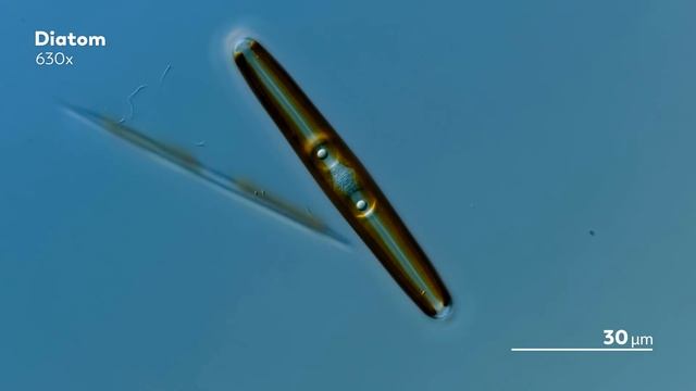 The Tiny Worlds Inside of Single-Celled Organisms смотреть онлайн