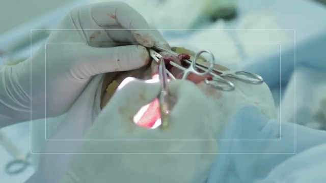 Полная ринопластика смотреть онлайн
