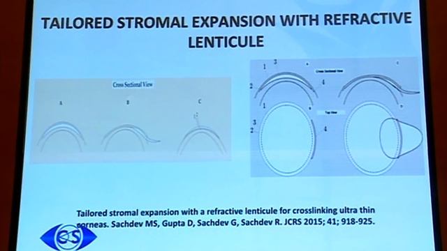 AIOC2018 - IC026 - A to Z of Collagen Cross Linking. смотреть онлайн