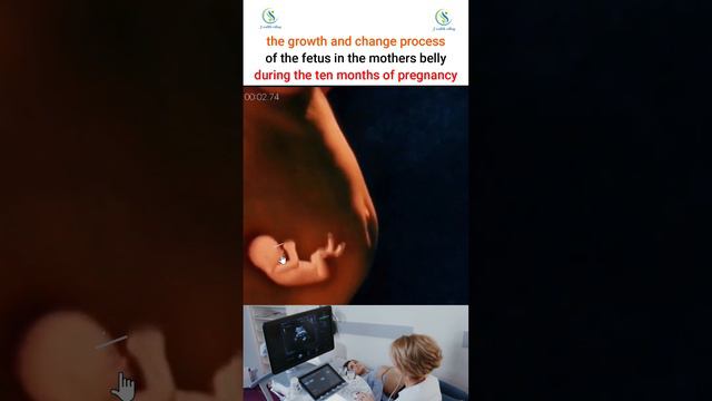 How many weeks are you pregnant? #pregnant #fetus #amniotic #fluid #foryou #pregnant #ultrasound смотреть онлайн