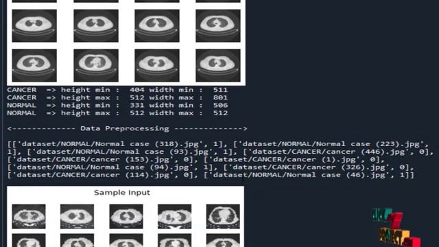 Python Image Processing Lung Disease Predictiion - ClickMyProject смотреть онлайн