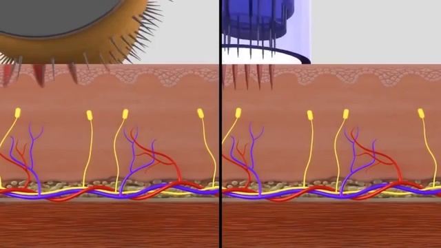 Dermapen v Dermaroller смотреть онлайн