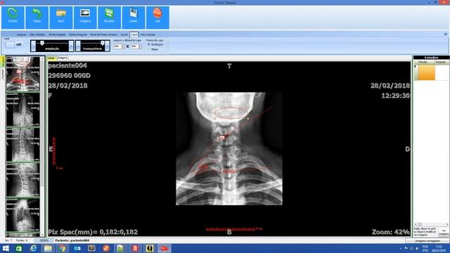 Visor dicom com delphi xe8 com dll feita em delphi смотреть онлайн