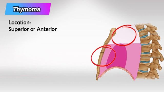 The Hidden Chamber: Anatomy and Structures of the Mediastinum смотреть онлайн