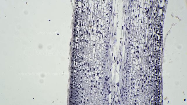 Root tip of Allium cepa in longitudinal section magnified by microscope 100x on bright field смотреть онлайн