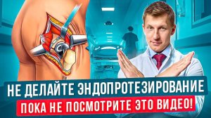 Вся правда об эндопротезировании тазобедренного сустава. Операция по замене тазобедренного сустава.