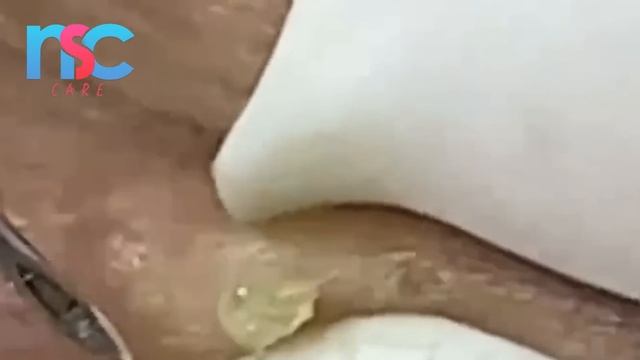 Enjoy The Surprise From LoanNguyen #959