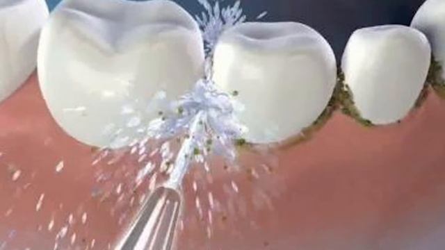 Water Irrigator on sale 2022 | Ovonni Water Flosser Review | Dental Wellbeing смотреть онлайн