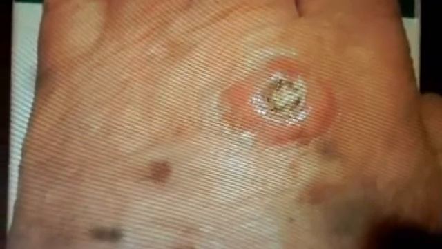 Внимание! На Полесье оленья кровососка смотреть онлайн