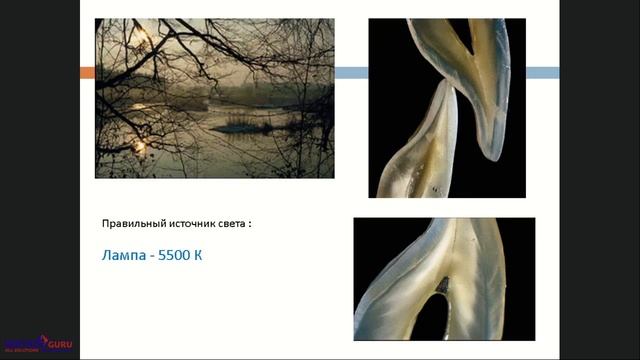 2018 01 17 Как правильно определять цвет зубов и анализировать форму смотреть онлайн