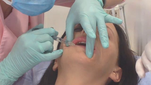 Аириском: студенты учатся. Первая практика - филлеры губы