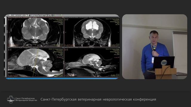 Гидроцефалия как надо лечить. смотреть онлайн
