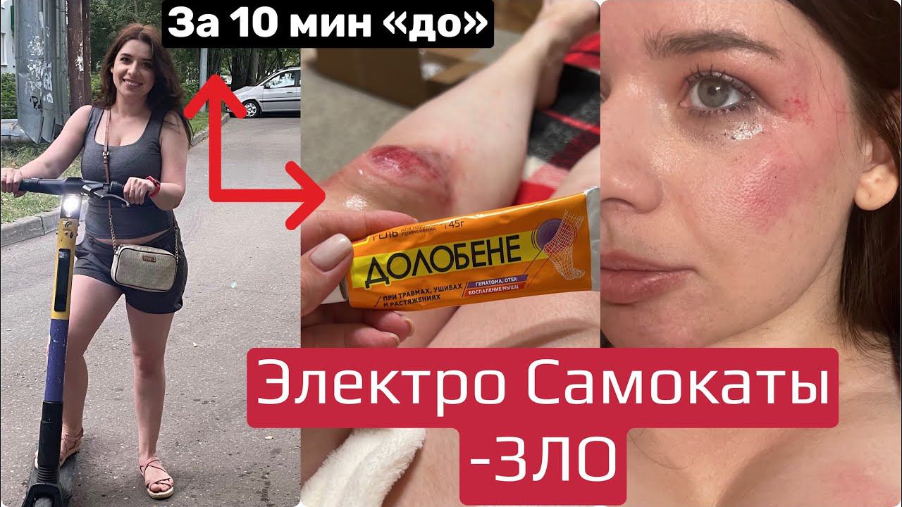 ПАДЕНИЕ С ЭЛЕКТРО-САМОКАТА! МОЯ ИСТОРИЯ И ПОЧЕМУ ОТКАЗАЛИ ТОРМОЗА? смотреть онлайн