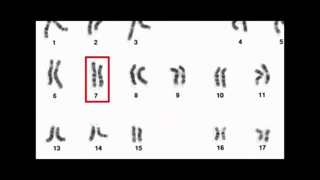 DON'T GIVE UP//genética y herencia//fibrosis quística смотреть онлайн