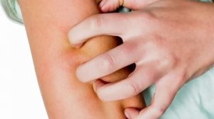 Ранние ПРИЗНАКИ болезни ПЕЧЕНИ / симптомы болезни #печень